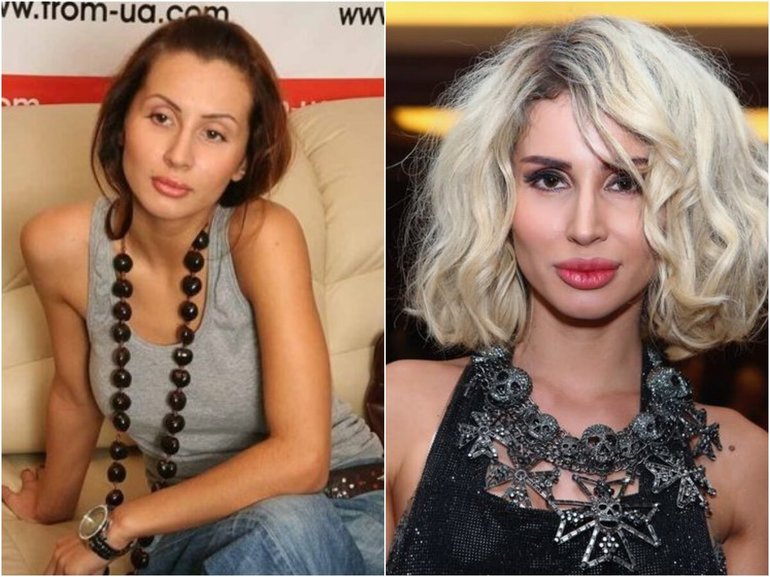 Фото Светланы Лободы До И После